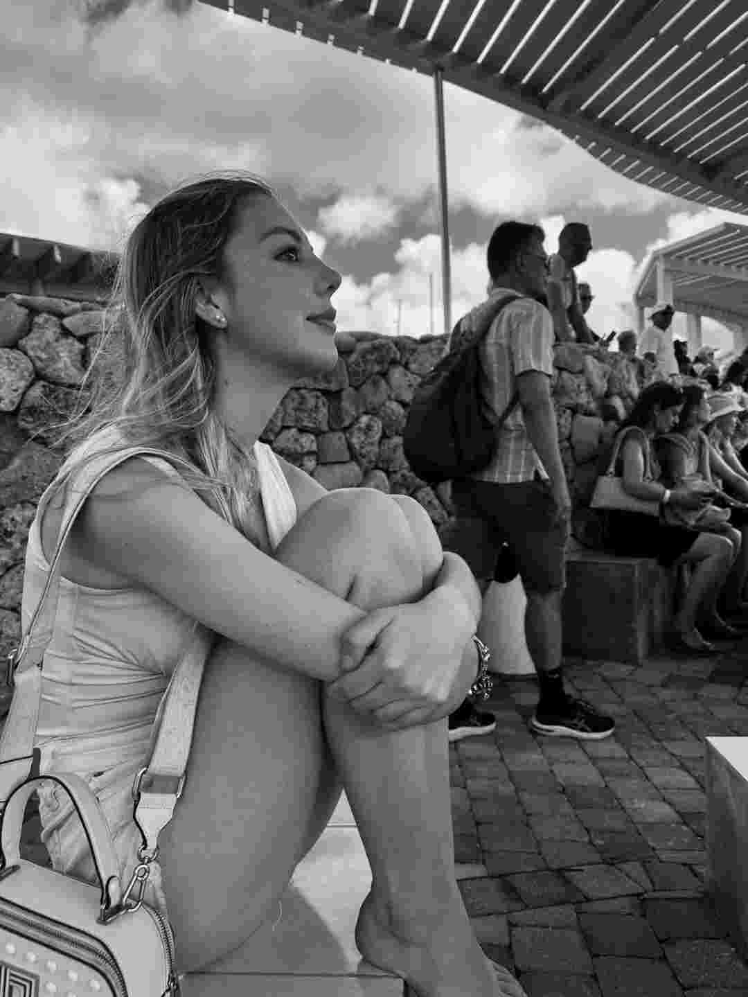 Rinoplastia Estructural