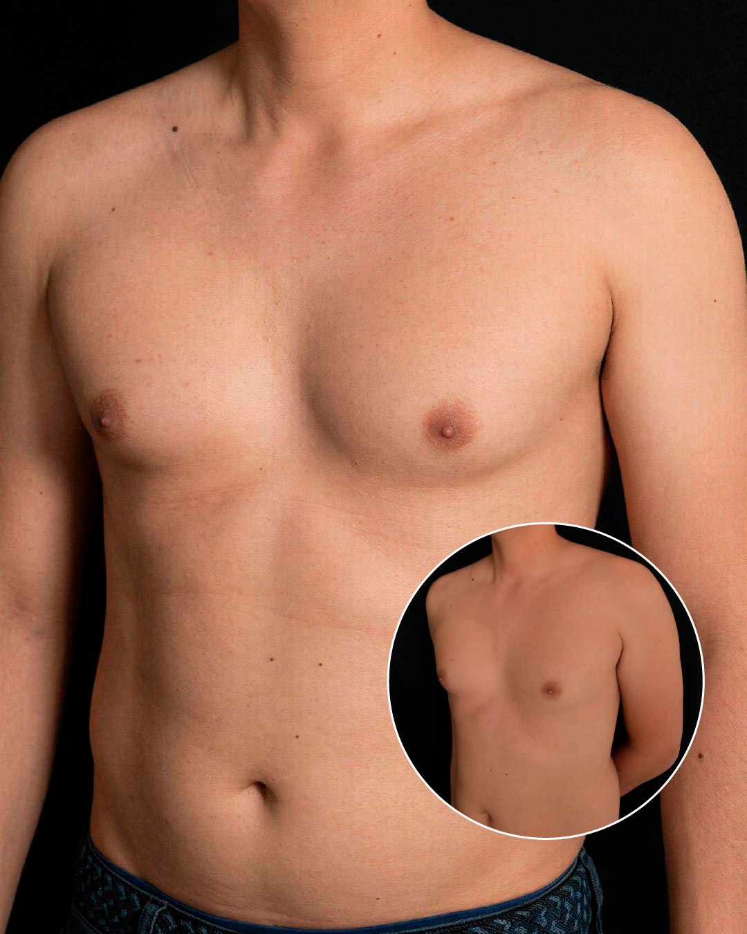 Cirugía plástica masculina Bogotá