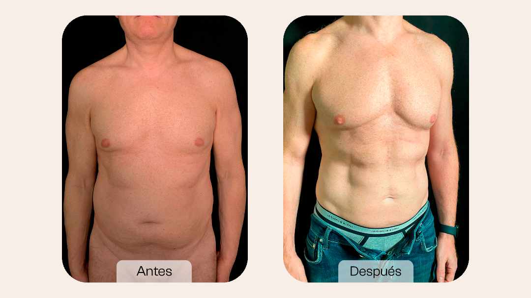 Cirugía plástica masculina Bogotá